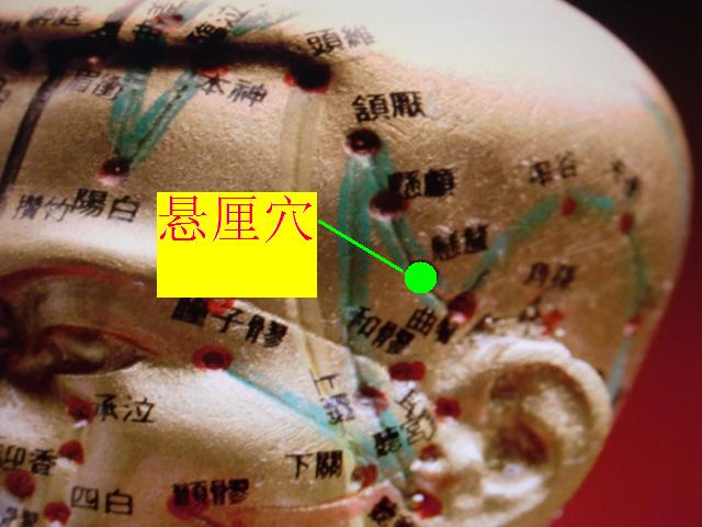 悬厘穴位位置图 悬厘穴的功效作用_国医在线_guoyi163.com