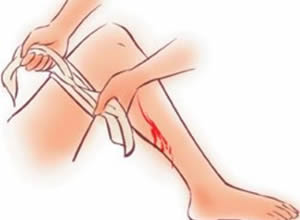 尿血、牙龈出血、鼻出血怎么止？快去厨房找止血药